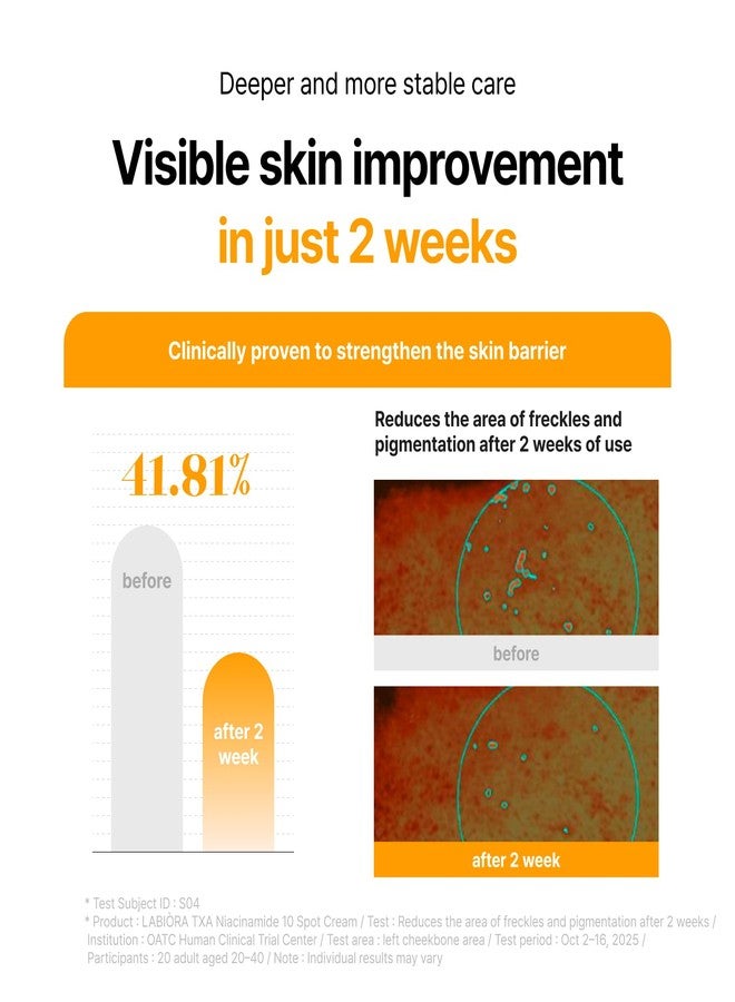 LABIORA CARE CREAM with TXA NIACINAMIDE for Uneven Skin Tone, Brightening & Radiance Support with Tranexamic Acid 6%, Niacinamide 4%, Glutathione & Arbutin, 0.67 fl oz - Image 5